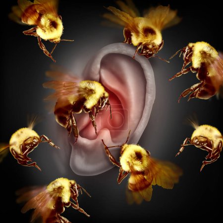 Síntoma de tinnitus y zumbido en el oído como abejas que hacen un sonido zumbante como síntoma médico y diagnóstico de pérdida auditiva en un estilo de ilustración 3D.