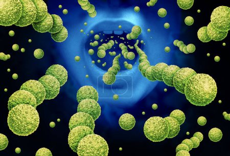 Streptococcus oral Bacterias e infecciones estreptocócicas como brote bacteriano gram-positivo como división celular esférica de Streptococcaceae que se extiende y crece en cadenas como una enfermedad infecciosa como enfermedades estreptocócicas como infección del seno faríngeo estreptocócico