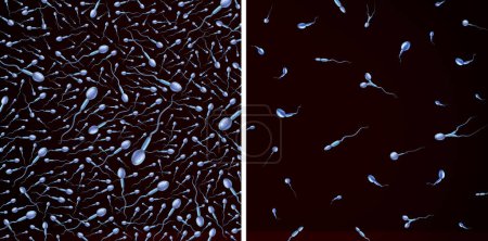 Nombre de spermatozoïdes et qualité en tant qu'infertilité masculine et problèmes de reproduction en tant que spermatozoïdes microscopiques sains ou anormaux nageant pour fertiliser comme symbole d'urologie.