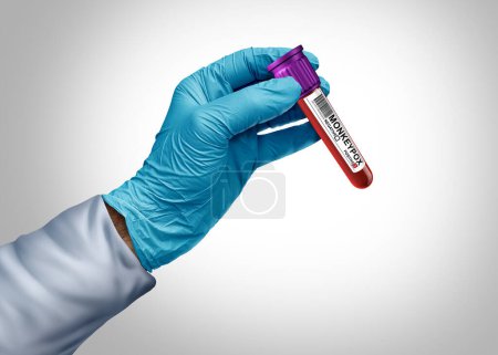 Éclosion de virus de la variole du singe ou pandémie de mpox en tant que médecin ou scientifique testant le sang infecté par un agent pathogène viral infectant les humains en tant que concept scientifique de virologie.