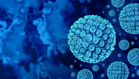 Brote de virus del Norovirus o infección viral de Norwalk como patógeno contagioso que causa gastroenteritis o gripe estomacal o gripe que resulta en vómitos diarrea náuseas síntomas.