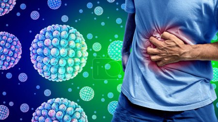 Norovirus Magenschmerzen als Person mit Bauchschmerzen und Krämpfen aufgrund eines ansteckenden grippalen Infekts als Magenschmerzen Viruserkrankung.