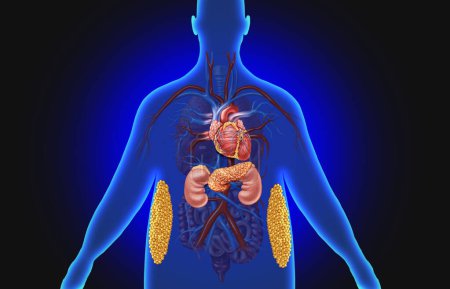 Multisystemstörung und kardiovaskuläres Nierenmetabolisches Syndrom als Krankheit, die mit einer Gruppe von Organen wie der Niere, der Bauchspeicheldrüse und den Fettzellen zusammenhängt.