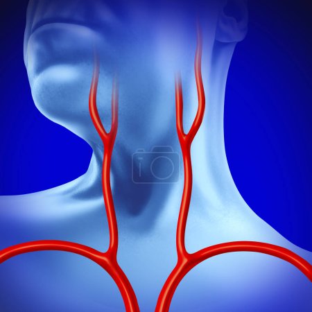 Arteria carotídea humana como arterias que llevan el flujo de vasos sanguíneos al cerebro como medicina cerebrovascular y cardiológica.