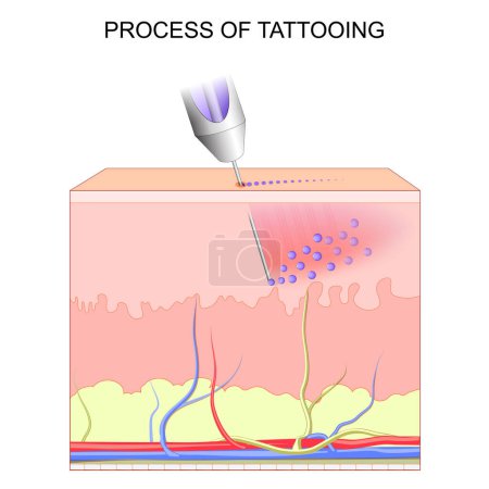 tattoo making. Cross section of layers of a human skin. Close-up of Process of tattooing. pigments in Tattoo inks. permanent makeup. vector poster