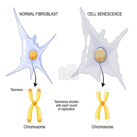 Illustration for Chromosome of a Normal fibroblast and Cell senescence. Telomeres shorten with each round of replication. aging process. Vector poster - Royalty Free Image