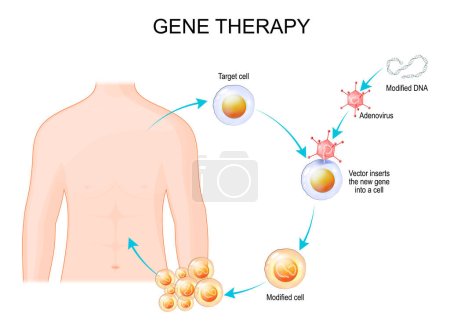 Illustration for Genetic engineering. Gene therapy using an adenovirus vector. virus inserts the new gene into a cell, that will make proteins to treat a disease. vector illustration - Royalty Free Image
