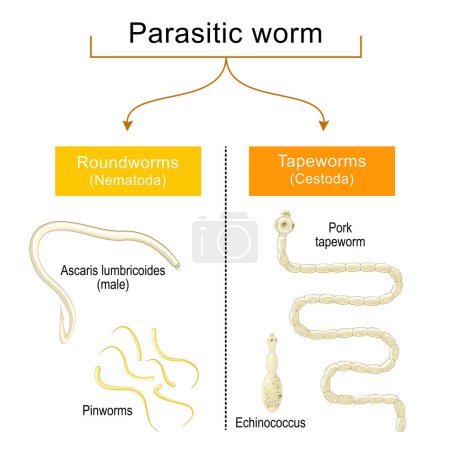 Téléchargez les illustrations : Worm infection. Helminthiasis. Common types of parasitic worms or helminths: tapeworms, and roundworms that infected of human gastrointestinal tract. Pinworms and Ascaris lumbricoides, Pork tapeworm and Echinococcus. vector poster - en licence libre de droit