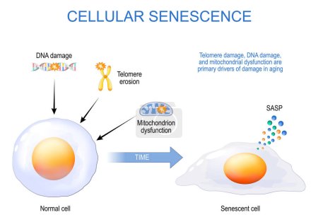 Illustration for Cellular senescence. From Normal to Senescent cell. Telomere and DNA damaged, mitochondrial dysfunction are primary drivers of damage in aging. Anti-aging therapy. Senescence-associated secretory phenotype SASP. Anti aging medicine. vector poster - Royalty Free Image