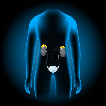 Illustration for Adrenal glands location. realistic kidneys and suprarenal glands into x-ray blue torso. Human silhouette on dark background. Endocrine system. Human body anatomy. Vector poster - Royalty Free Image