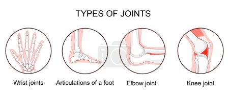 Types of joints. Biomechanical and anatomical classification. Set icons with human elbow, knee, wrist joints, and Articulations of a foot. bones and joints. medical poster for clinic. vector illustration.
