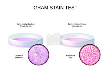 Illustration for Gram stain test. glass Petri dish with culture Gram-negative bacteria Escherichia coli after used of crystal violet stain. Close-up of Gram-positive bacteria Clostridium perfringens. Vector illustration - Royalty Free Image