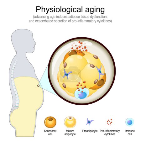 Illustration for Physiological Aging. Cellular senescence and Adipocyte changes with age. Aging process, Insulin resistance and diabetes. Vector illustration - Royalty Free Image