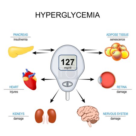 hyperglycemia. Insulin resistance. Relationship between senescence cell, High blood sugar level and complications of Diabetes mellitus. Vector illustration