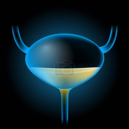 Bladder with urine. Realistic transparent blue bladder on dark background. Human urinary System. Image for healthcare design. Illustration about excretory system. Vector diagram