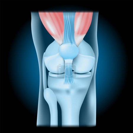 Illustration for Knee joint with Quadriceps. Front view of human knee with glowing effect. Realistic transparent blue joint on dark background. vector illustration like X-ray image. - Royalty Free Image