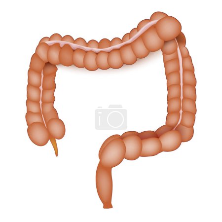 Ilustración de Anatomía del intestino grueso. Colón humano sobre un fondo blanco. Tracto intestinal del sistema digestivo. Intestino grueso. Ilustración vectorial - Imagen libre de derechos