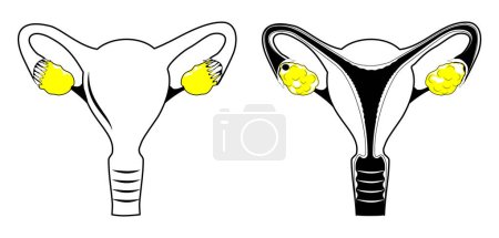 Illustration for Uterus. black line icon. Simple outline style. Stylized pictogram for web design, or mobile app about human reproductive system. Vector illustration. flat line symbol for medical or educational use. - Royalty Free Image
