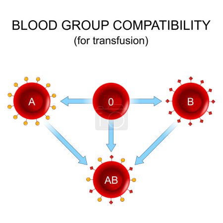 Téléchargez les illustrations : Compatibilité des groupes sanguins pour la transfusion. Donateur et bénéficiaire. Don de sang. Quatre groupes sanguins de base, constitués de combinaisons des antigènes du groupe A et du groupe B. Schéma vectoriel - en licence libre de droit