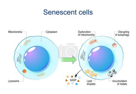 Senescent cells. Cellular senescence from Dysfunction of mitochondria, accumulation of metals, Disrupting of autophagy, Lipid droplets to release of Senescence-associated secretory phenotype SASP and chronic inflammation. DNA damage response. Aging c