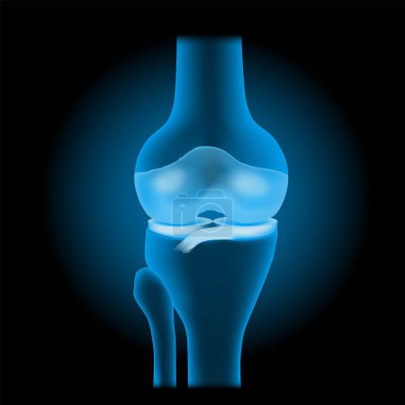 Illustration for Knee joint anatomy. Front view of human knee with glowing effect. Realistic transparent blue joint with bones, meniscus, ligaments and cartilage on dark background. vector illustration like X-ray image. - Royalty Free Image