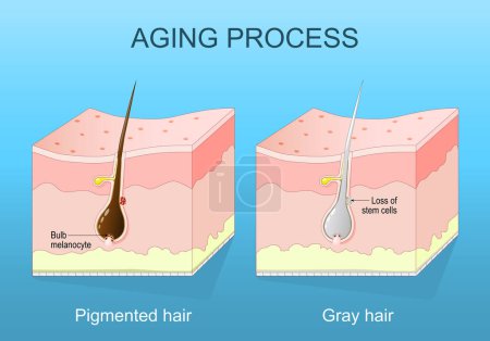 Illustration for Aging process. Graying hair. Melanin depletion and Hair follicle senescence. Cross section of a human skin. isometric flat vector illustration - Royalty Free Image
