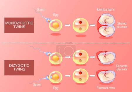 "Zygote development in monozygotic and dizygotic twins". De la fécondation, ovules et spermatozoïdes à la formation de sacs amniotiques. Vecteur isométrique. Illustration plate