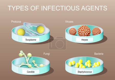 Illustration for Types of infectious agents. pathogens. Parasitic protozoan. Viruses, bacteria, fungi and unicellular organism. Petri dishes with Candida albicans, herpes viruses, staphylococcus, and toxoplasma. Vector poster. Isometric Flat illustration. - Royalty Free Image