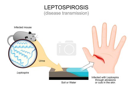 Leptospirose. Krankheitsübertragung von infizierter Maus auf Boden oder Wasser und Palme. Infiziert mit Leptospira durch Abschürfungen oder Schnitte in der Haut. Nahaufnahme von Spirochäten-Bakterien. Vektorillustration