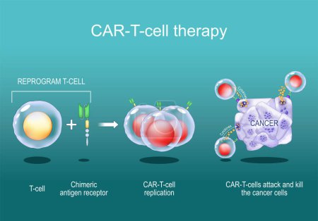 Thérapie par lymphocytes T. immunothérapie anticancéreuse. tuer des cellules tumorales. génétiquement modifié. Médecine personnalisée. Affiche vectorielle. Illustration plane isométrique.