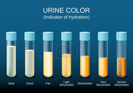 Urine color. Indicator of hydration. Laboratory test tubes with urine for check of dehydration. Isometric Flat vector illustration. Pee Color diagram.