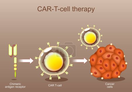 Terapia con células CAR-T. inmunoterapia contra el cáncer. Receptor de antígeno quimérico. Ingeniería genética. Medicina personalizada. Orientación tumoral. Ilustración vectorial. Ilustración isométrica vector plano.