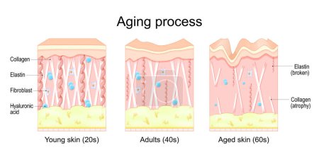 Alterungsprozess. Vergleich von junger, erwachsener und alter Haut. Kollagen, Elastin, Hyaluronsäure und Fibroblasten in der jüngeren und älteren Haut. altersbedingte Veränderungen der Haut, wenn Kollagenfasern verkümmern und Elastin kaputt geht. Vektorillustration
