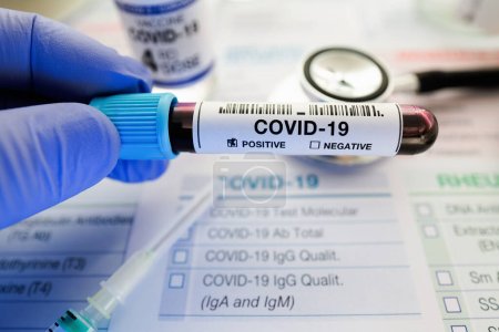 Photo for Technican testing blood sample with presence positive to corona virus. Doctor holding tube of blood sample in the laboratory identified with Positive COVID-19 or Coronavirus - Royalty Free Image