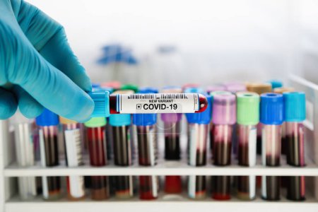 Foto de Investigador en laboratorio de análisis que contiene un tubo de muestra de sangre de una nueva cepa de mutación por Coronavirus. Médico con muestra de sangre etiquetada con Nueva Variante del Covid-19 - Imagen libre de derechos