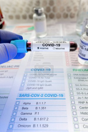 Photo for Doctor holding tube of blood sample in the laboratory identified with Positive COVID-19 or Coronavirus. Technican testing blood sample with presence positive to coronavirus - Royalty Free Image