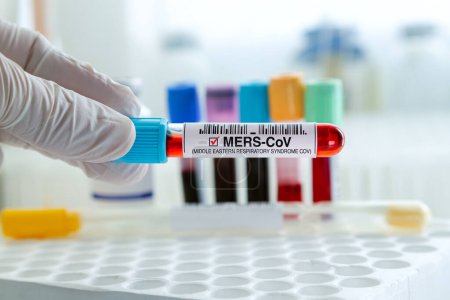 Photo for Doctor holding tube of blood sampleidentified with Positive to MERS-CoV or Camel virus in the laboratory. Technican testing blood sample with presence positive to MERS-CoV virus - Royalty Free Image