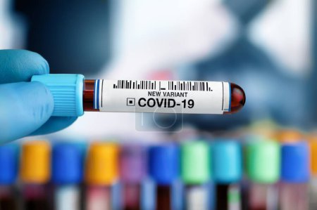 Foto de Médico sosteniendo tubo de muestra de sangre en el laboratorio identificado con variantes positivas COVID-19 o Coronavirus. Prueba técnica de muestra de sangre con presencia positiva a coronavirus de nueva variante - Imagen libre de derechos