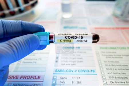 Foto de Médico sosteniendo un tubo de muestra de sangre en el laboratorio identificado con COVID-19 positivo o Coronavirus. Muestra de sangre técnica en posesión con presencia positiva de covid o coronavirus sobre forma de requisición - Imagen libre de derechos