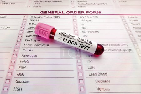 Photo for Blood testing from a patient on the test request form requested by the doctor for medical review. Blood test tube and form with list of analysis tests in medical laboratory - Royalty Free Image