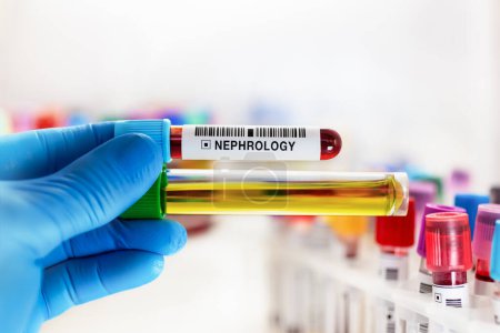 Photo for Doctor working with Blood drawn for Nephrology test. Technician lab holding Blood sample with requisition form for renal function test - Royalty Free Image