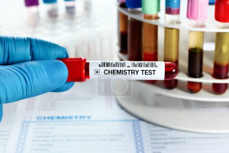 Photo for Technician lab holding Blood sample tube for analysis of blood chemistry study in the laboratory. Doctor holding Blood test over requisition report for blood chemistry analysis - Royalty Free Image