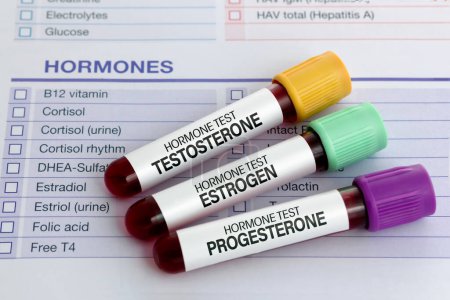 Foto de Muestras de sangre para las hormonas sexuales Análisis de testosterona, estrógeno y progesterona en hombres y mujeres. Tubos de análisis de sangre para el análisis hormonal de testosterona, estrógeno y progesterona - Imagen libre de derechos
