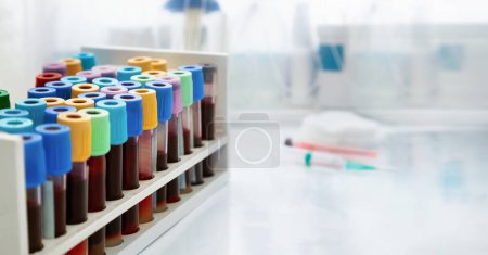 Photo for Workbench with tray with blood tests for examine in the hematology laboratory. Workplace Rack with tubes of blood samples from patients in the Clinical Analysis laboratory of the hospital - Royalty Free Image