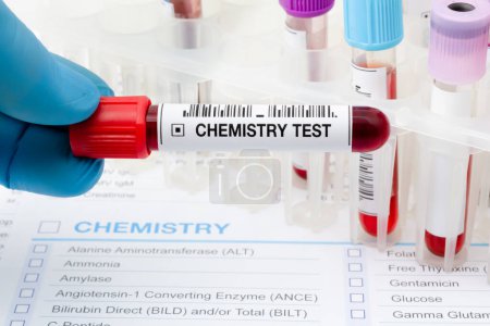 Photo for Doctor in Laboratory with collection of blood testing sample tube for Chemist analysis. Technician holding tube with blood sample from patient in the Chemistry test lab - Royalty Free Image