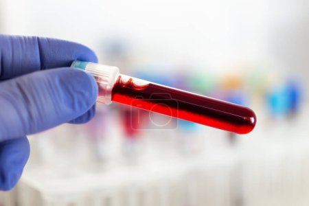 Photo for Technician with blood test tube to analyze in the research lab. Researcher holding blood sample tube for new Variant covid-19 diagnosis in the laboratory - Royalty Free Image