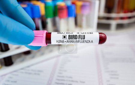 Foto de Técnico con prueba de tubo de recolección de sangre para el análisis de virus de influenza aviar A H3N8. Médico sosteniendo prueba de tubo sanguíneo para la enfermedad de la gripe aviar - Imagen libre de derechos
