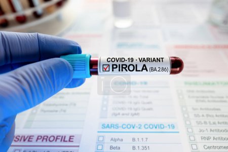 Foto de Blood sample test labeled with New Variant covid-19 PIROLA. Blood Analysis of Coronavirus Positive to Variant BA.2.86 - Imagen libre de derechos