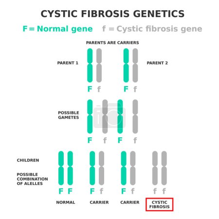 La génétique de la mucoviscidose. La fibrose kystique est un exemple de maladie récessive. Les parents sont porteurs de l'allèle affecté. Les enfants ont différentes combinaisons possibles de gènes. Illustration vectorielle. 