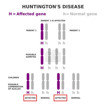 Huntington's disease genetics. Autosomal dominant inheritance. One parent is affected. Children have fifty fifty possibility of inheriting disease. Chromosome 4 HTT is mutated. Vector illustration.  